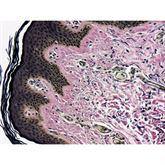 Histopathology Control Slides Elastic • Skin Pos ,10 / pk - Axiom Medical Supplies