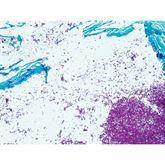 Histopathology Control Slides Fite, Nocardia sp. • Art Pos ,10 / pk - Axiom Medical Supplies