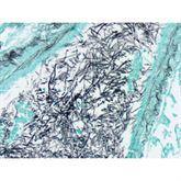 Histopathology Control Slides Fungus • GMS, Aspergillus sp. • Art Pos ,10 / pk - Axiom Medical Supplies