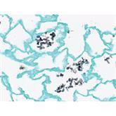 Histopathology Control Slides Fungus • GMS, Candida sp. • Art Pos ,10 / pk - Axiom Medical Supplies
