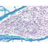 Histopathology Control Slides Fungus • PAS • Aspergillus sp. • Art Pos ,10 / pk - Axiom Medical Supplies