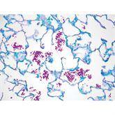 Histopathology Control Slides Fungus • PAS • Candida sp. • Art Pos ,10 / pk - Axiom Medical Supplies