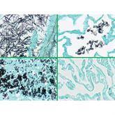 Histopathology Control Slides Fungus • GMS • Multi-Tissue • Art Pos ,10 / pk - Axiom Medical Supplies