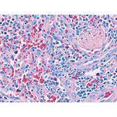 Histopathology Control Slides Giemsa Pos ,10 / pk - Axiom Medical Supplies