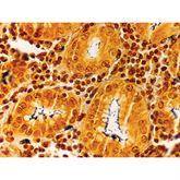 Histopathology Control Slides Histo Path Helicobacter sp. Animal Pos ,10 / pk - Axiom Medical Supplies