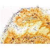 Histopathology Control Slides Histo Path Helicobacter sp. • Pos ,10 / pk - Axiom Medical Supplies