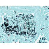 Histopathology Control Slides Histoplasma sp. • Animal Pos ,10 / pk - Axiom Medical Supplies