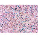 Histopathology Control Slides Iron • Pos ,10 / pk - Axiom Medical Supplies