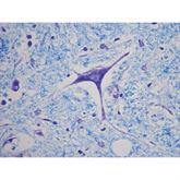 Histopathology Control Slides Luxol Fast Blue(LFB)-Cresyl Violet Pos ,10 / pk - Axiom Medical Supplies