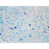 Histopathology Control Slides Mast Cell Pos ,10 / pk - Axiom Medical Supplies