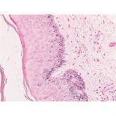 Histopathology Control Slides Melanin Pos ,10 / pk - Axiom Medical Supplies