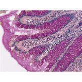 Histopathology Control Slides Mucin Mucicarmine Pos ,10 / pk - Axiom Medical Supplies