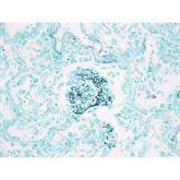 Histopathology Control Slides Pneumocystis sp. Pos ,10 / pk - Axiom Medical Supplies