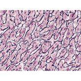 Histopathology Control Slides Reticulum Pos ,10 / pk - Axiom Medical Supplies