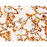 Histopathology Control Slides Spirochete • Artificial Pos ,10 / pk - Axiom Medical Supplies