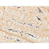 Histopathology Control Slides Spirochete • Animal Pos ,10 / pk - Axiom Medical Supplies