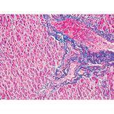Histopathology Control Slides Trichrome • Liver Pos ,10 / pk - Axiom Medical Supplies