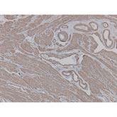 Immunopathology Control Slides Actin • Smooth Muscle Pos ,10 / pk - Axiom Medical Supplies