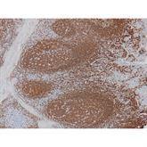 Immunopathology Control Slides CD20 • B-Cell Pos ,10 / pk - Axiom Medical Supplies