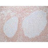 Immunopathology Control Slides BCL2 Pos ,10 / pk - Axiom Medical Supplies