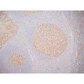 Immunopathology Control Slides BCL6 Pos ,10 / pk - Axiom Medical Supplies