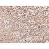 Immunopathology Control Slides Alpha-Fetoprotein (AFP) Pos ,10 / pk - Axiom Medical Supplies