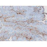 Immunopathology Control Slides CA-125 Pos ,10 / pk - Axiom Medical Supplies