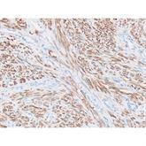 Immunopathology Control Slides Calponin Pos ,10 / pk - Axiom Medical Supplies