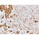 Immunopathology Control Slides Calretinin Pos ,10 / pk - Axiom Medical Supplies