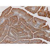 Immunopathology Control Slides Carcinoembryonic Antigen (CEA) Pos ,10 / pk - Axiom Medical Supplies