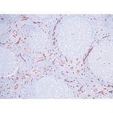 Immunopathology Control Slides CD8 Pos ,10 / pk - Axiom Medical Supplies