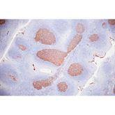 Immunopathology Control Slides CD10 Pos ,10 / pk - Axiom Medical Supplies