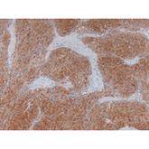 Immunopathology Control Slides CD117 • c-Kit Pos ,10 / pk - Axiom Medical Supplies