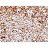 Immunopathology Control Slides CD31 PECAM-1 Pos ,10 / pk - Axiom Medical Supplies