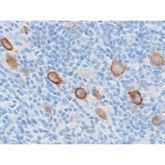 Immunopathology Control Slides CD30 Pos ,10 / pk - Axiom Medical Supplies