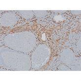 Immunopathology Control Slides CD34 Pos ,10 / pk - Axiom Medical Supplies