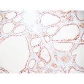 Immunopathology Control Slides CD56 Pos ,10 / pk - Axiom Medical Supplies