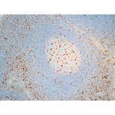 Immunopathology Control Slides CD68 Pos ,10 / pk - Axiom Medical Supplies