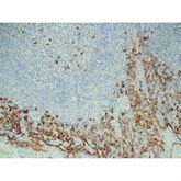 Immunopathology Control Slides CD138 Pos ,10 / pk - Axiom Medical Supplies