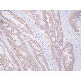 Immunopathology Control Slides CDX2 Pos ,10 / pk - Axiom Medical Supplies