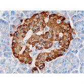 Immunopathology Control Slides Chromogranin A Pos ,10 / pk - Axiom Medical Supplies