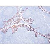 Immunopathology Control Slides Cytokeratin 5/6 (CK5/6) Pos ,10 / pk - Axiom Medical Supplies