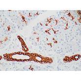 Immunopathology Control Slides Cytokeratin 7 (CK7) Pos ,10 / pk - Axiom Medical Supplies