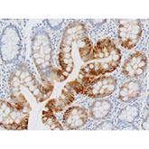 Immunopathology Control Slides Cytokeratin 20 (CK20) Pos ,10 / pk - Axiom Medical Supplies