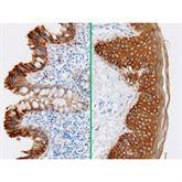 Immunopathology Control Slides Cytokeratin AE1/AE3 Pos ,10 / pk - Axiom Medical Supplies