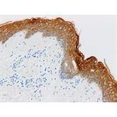 Immunopathology Control Slides Cytokeratin • HMW Pos ,10 / pk - Axiom Medical Supplies