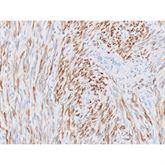 Immunopathology Control Slides Desmin Pos ,10 / pk - Axiom Medical Supplies