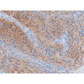 Immunopathology Control Slides DOG1 Pos ,10 / pk - Axiom Medical Supplies