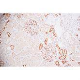 Immunopathology Control Slides GATA3 Pos ,10 / pk - Axiom Medical Supplies