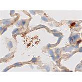 Immunopathology Control Slides Immunopath Helicobacter sp. Artificial Pos ,10 / pk - Axiom Medical Supplies